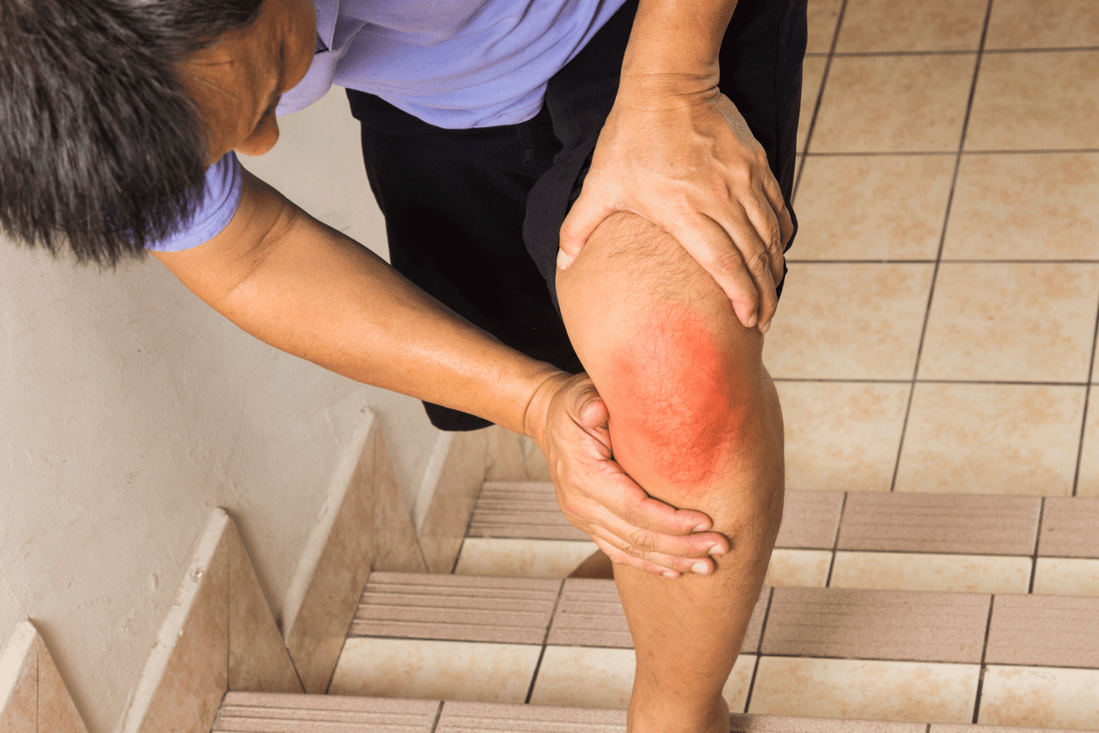 durere și inflamație a articulației genunchiului durere sub omoplat din spate